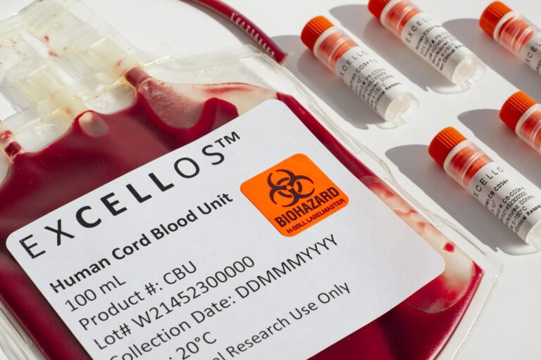 Close-up of an Excellos Human Cord Blood Unit showing the detailed product label with BIOHAZARD warning. The 100 mL blood bag contains red cord blood with visible product ID, lot number W21452300000, and storage temperature requirement of 20°C. Research-grade cell therapy vials appear in the background